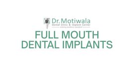 Full Mouth Dental Implants